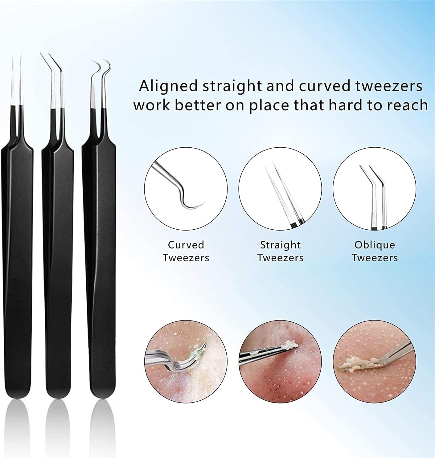 Pimple Popper Tool Kit 11 Pcs, Blackhead Remover Pimple Extractor Tools with Metal Case for Quick and Easy Removal of Blackheads,Pimples,Whiteheads,Zit Popper,Forehead,Facial and Nose (Black)